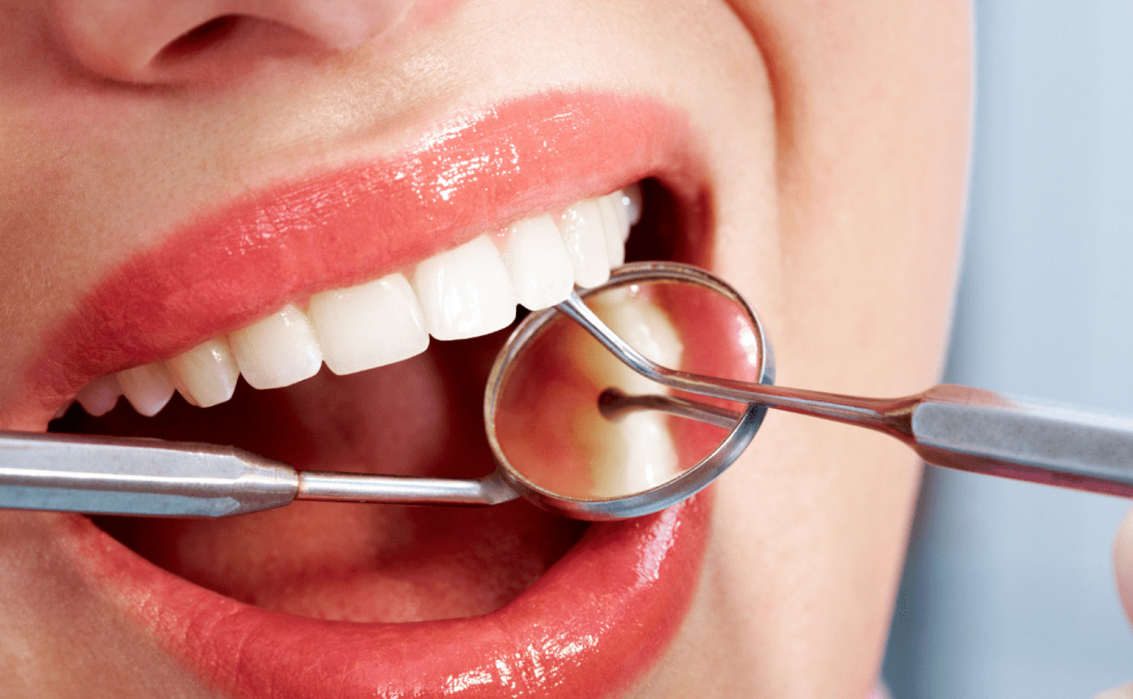 Conservativa-ed-endodonzia-Catania-airone