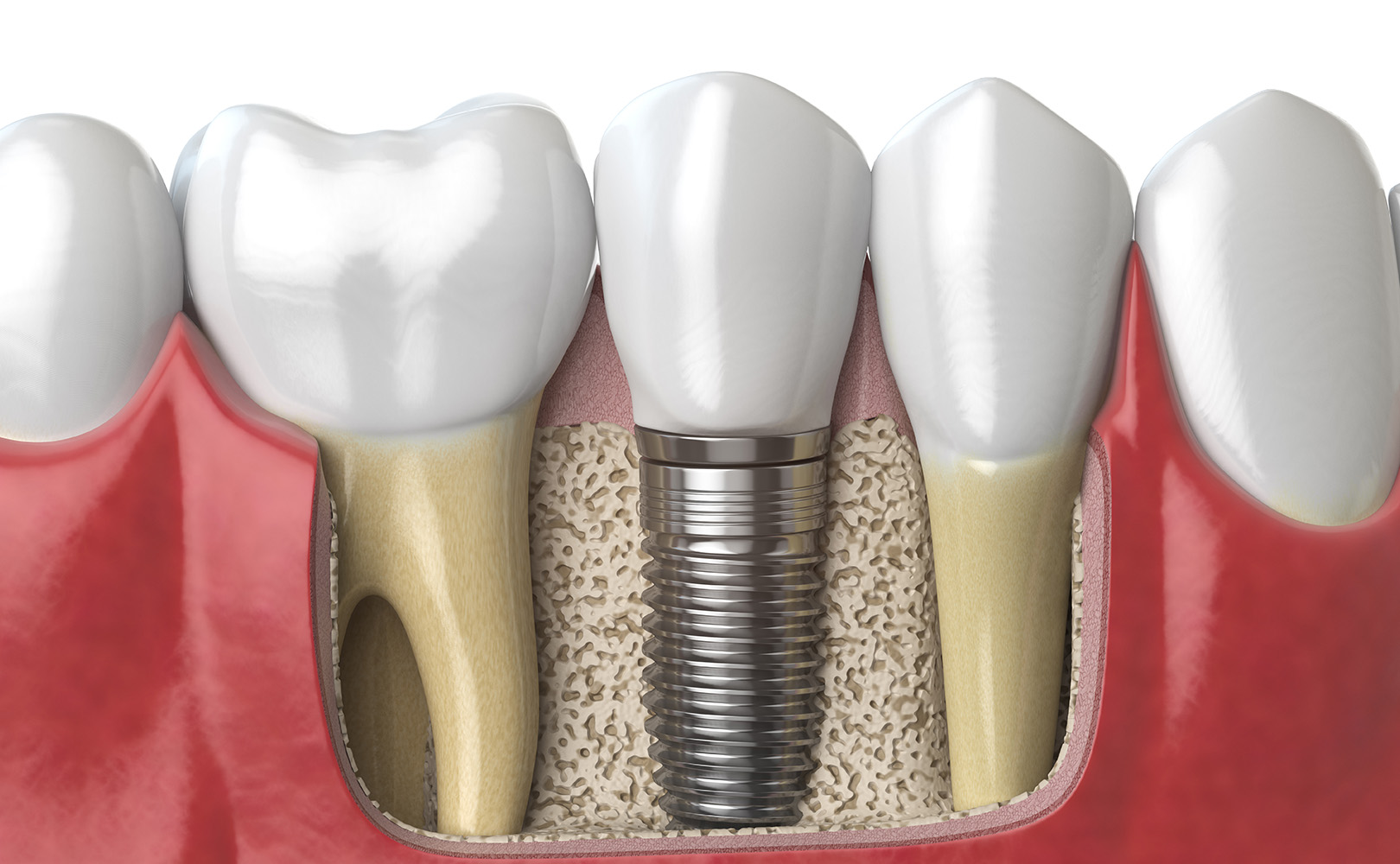 studio-dentistico-airone-a-paterno-08