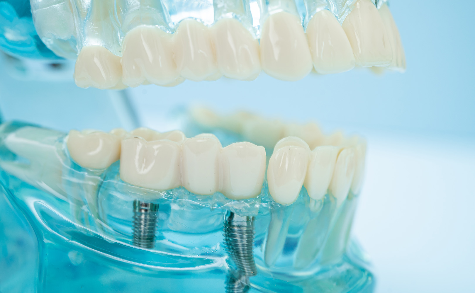 studio-dentistico-airone-paterno